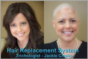 Don't let Medical Hair Loss for Chemo hold you or your style in chains. Life is so much more rewarding. Let Ms. Jackie help you in your new journey with a new image that is just beautiful as you are.