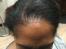Customizing And Tailoring A Unit Hairline - Healthy Hair Clinic